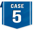 CASE5